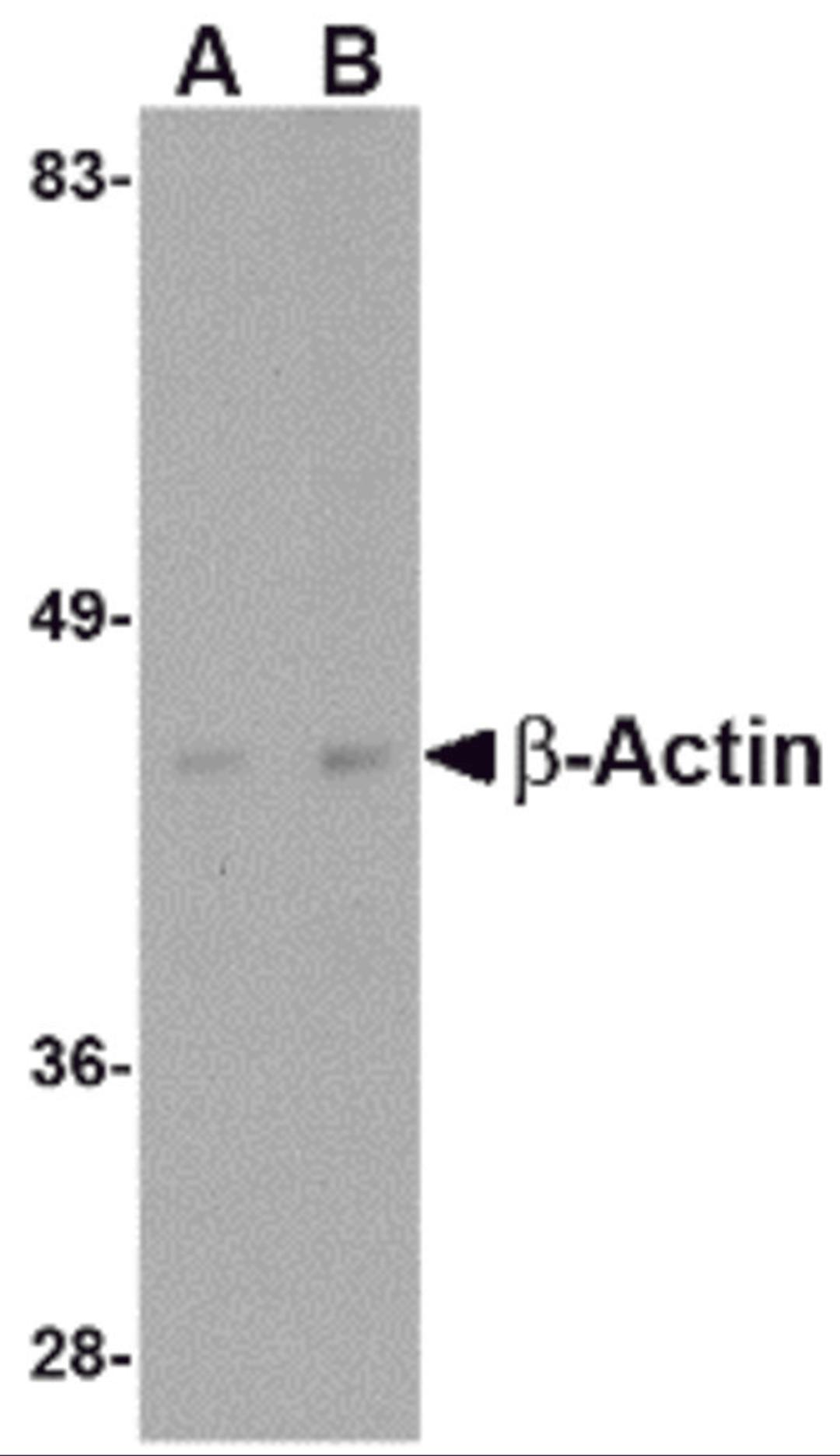 Western blot analysis of actin in HeLa cell lysate with beta-actin antibody at (A) 1 and (B) 2 μg/mL.