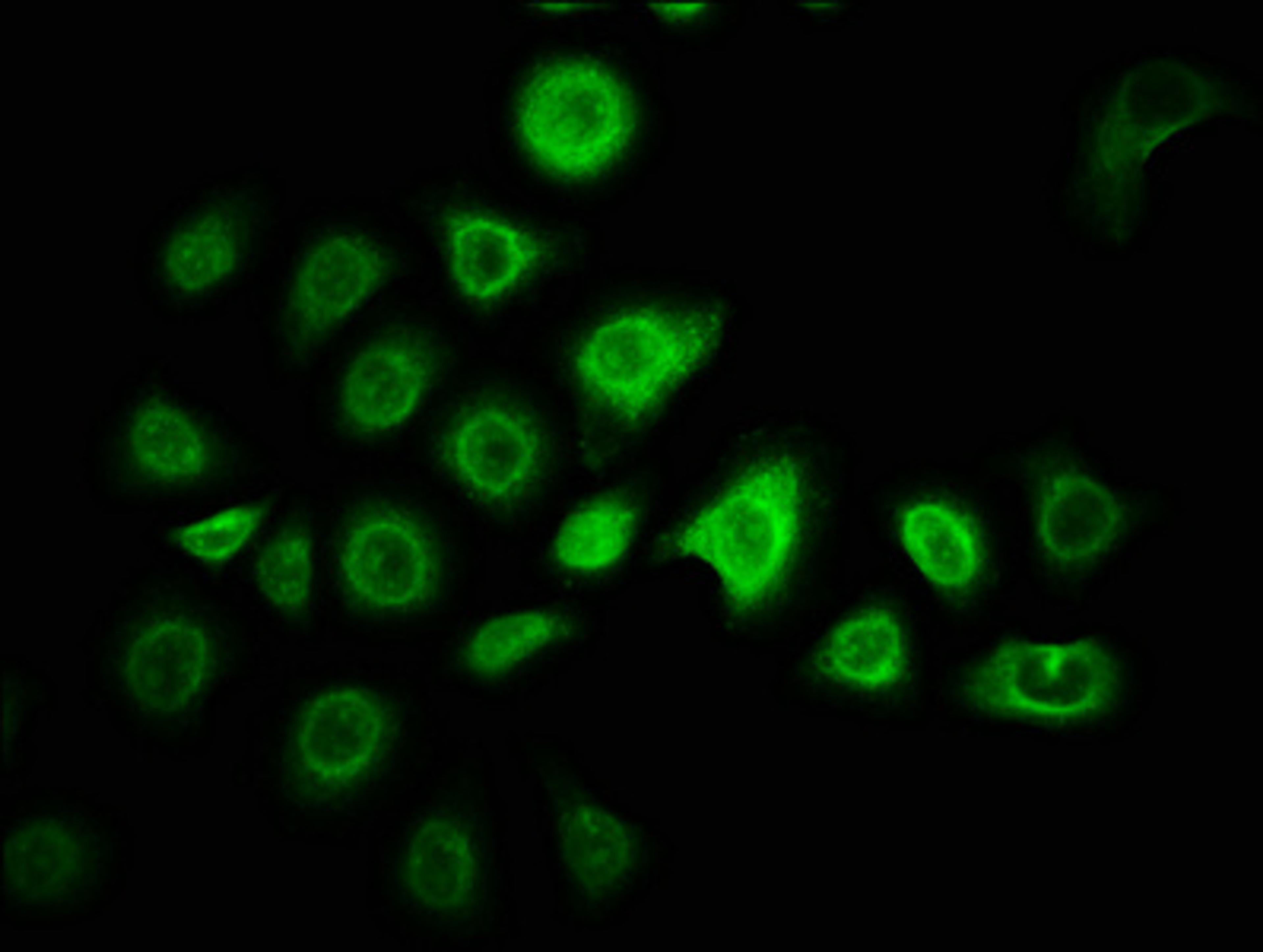 Immunofluorescence staining of A549 cells with CSB-PA026785LA01HU at 1:166, counter-stained with DAPI. The cells were fixed in 4% formaldehyde, permeabilized using 0.2% Triton X-100 and blocked in 10% normal Goat Serum. The cells were then incubated with the antibody overnight at 4&deg;C. The secondary antibody was Alexa Fluor 488-congugated AffiniPure Goat Anti-Rabbit IgG(H+L).