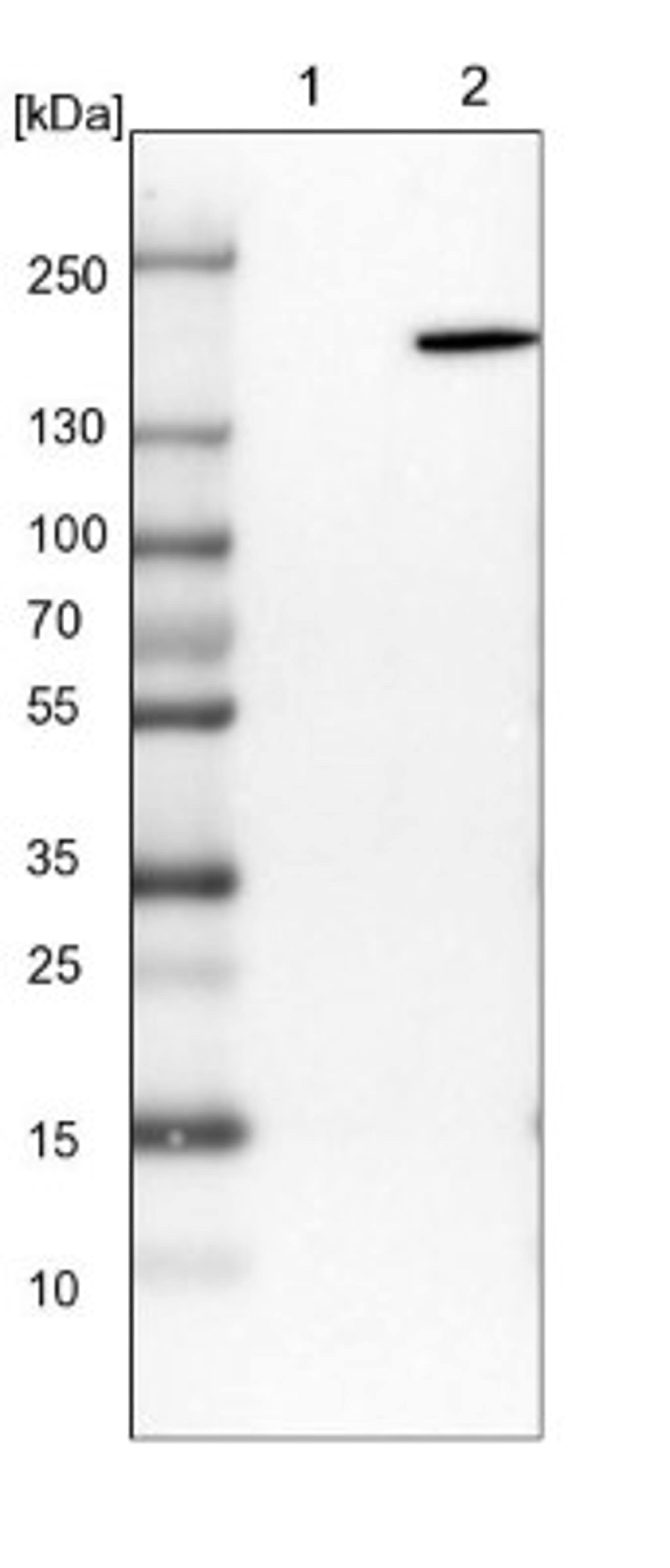 Western Blot: EPRS Antibody [NBP1-84929] - Lane 1: NIH-3T3 cell lysate (Mouse embryonic fibroblast cells)<br/>Lane 2: NBT-II cell lysate (Rat Wistar bladder tumour cells)