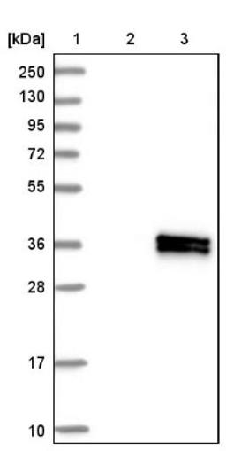 Western Blot: IL12A Antibody [NBP1-85564] - Lane 1: Marker [kDa] 250, 130, 95, 72, 55, 36, 28, 17, 10<br/>Lane 2: Negative control (vector only transfected HEK293T lysate)<br/>Lane 3: Over-expression lysate (Co-expressed with a C-terminal myc-DDK tag (~3.1 kDa) in mammalian HEK293T cells, LY400314)