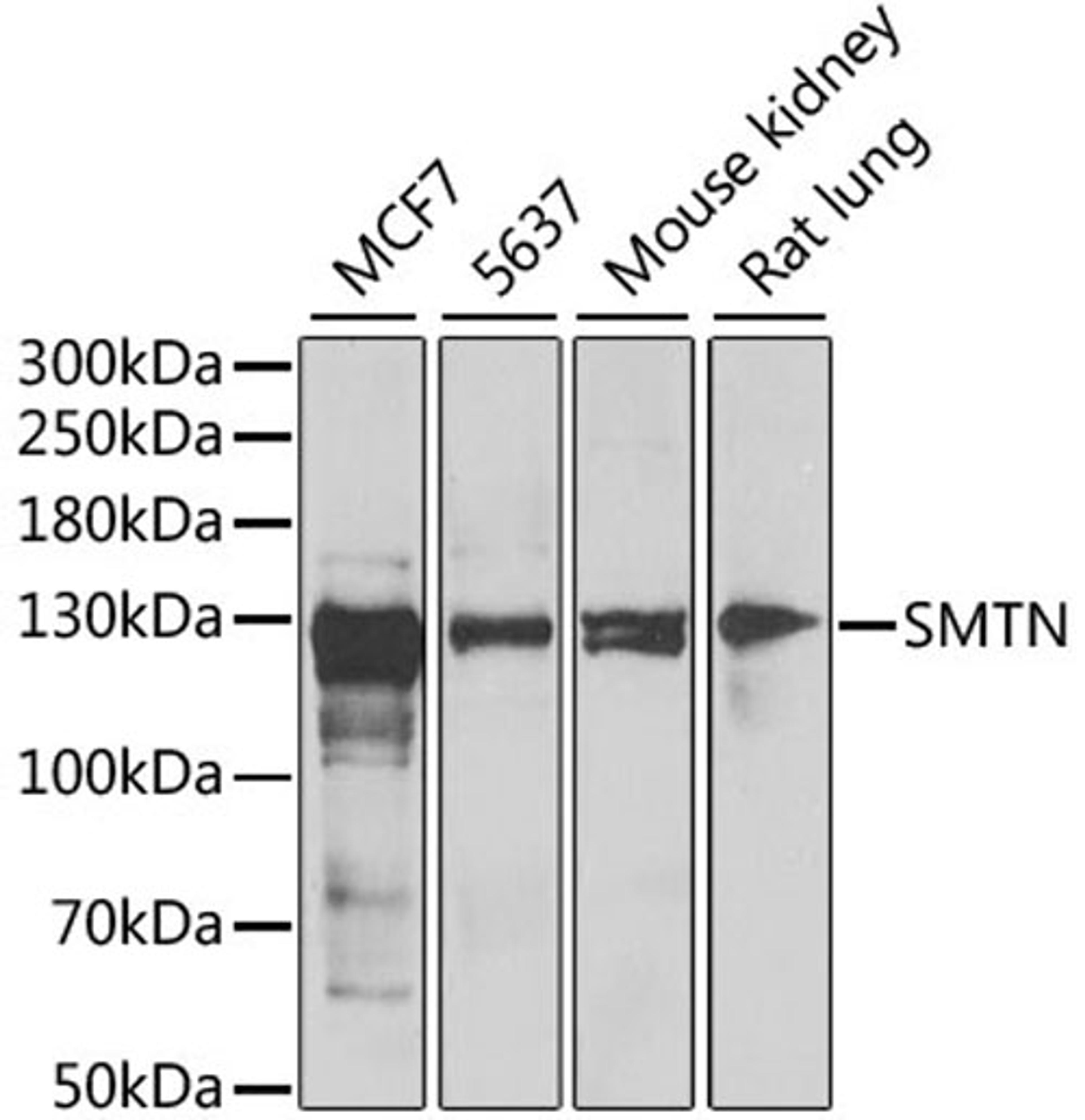 Western blot - SMTN antibody (A6745)