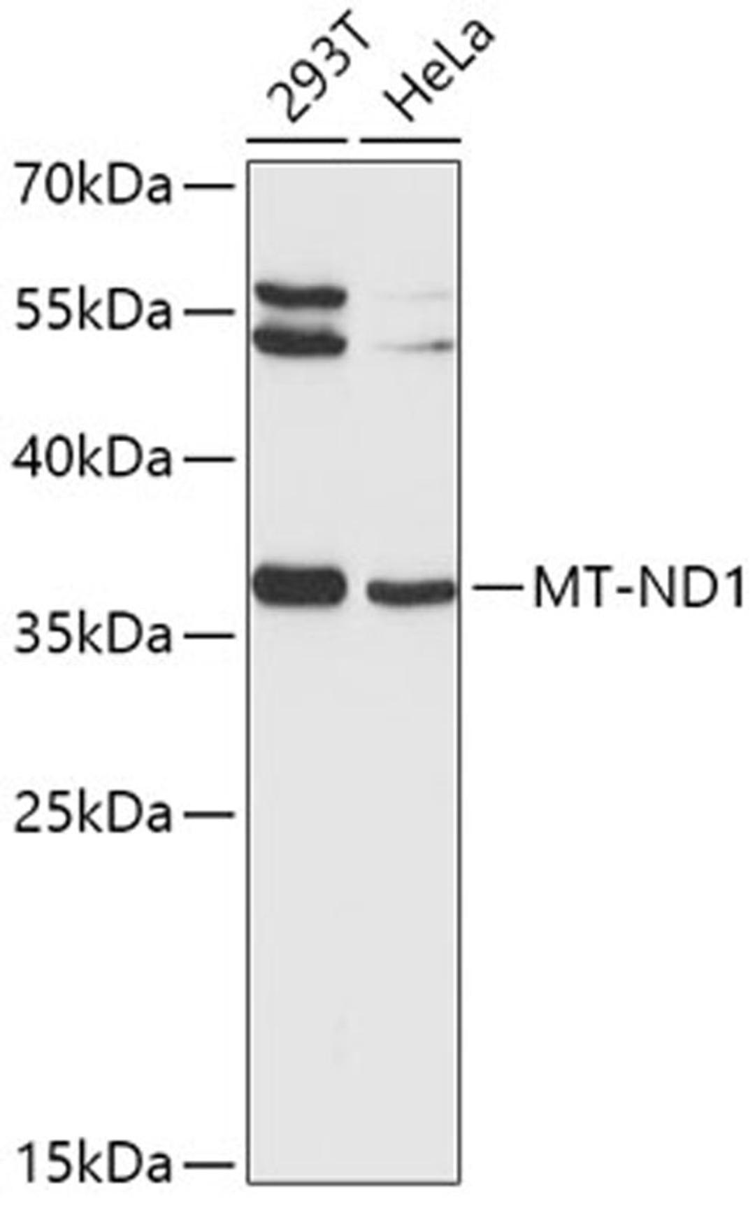 Western blot - MT-ND1 antibody (A5250)