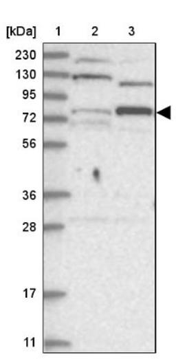 Western Blot: Zinc finger protein 287 Antibody [NBP1-82360] - Lane 1: Marker [kDa] 230, 130, 95, 72, 56, 36, 28, 17, 11<br/>Lane 2: Human cell line RT-4<br/>Lane 3: Human cell line U-251MG sp