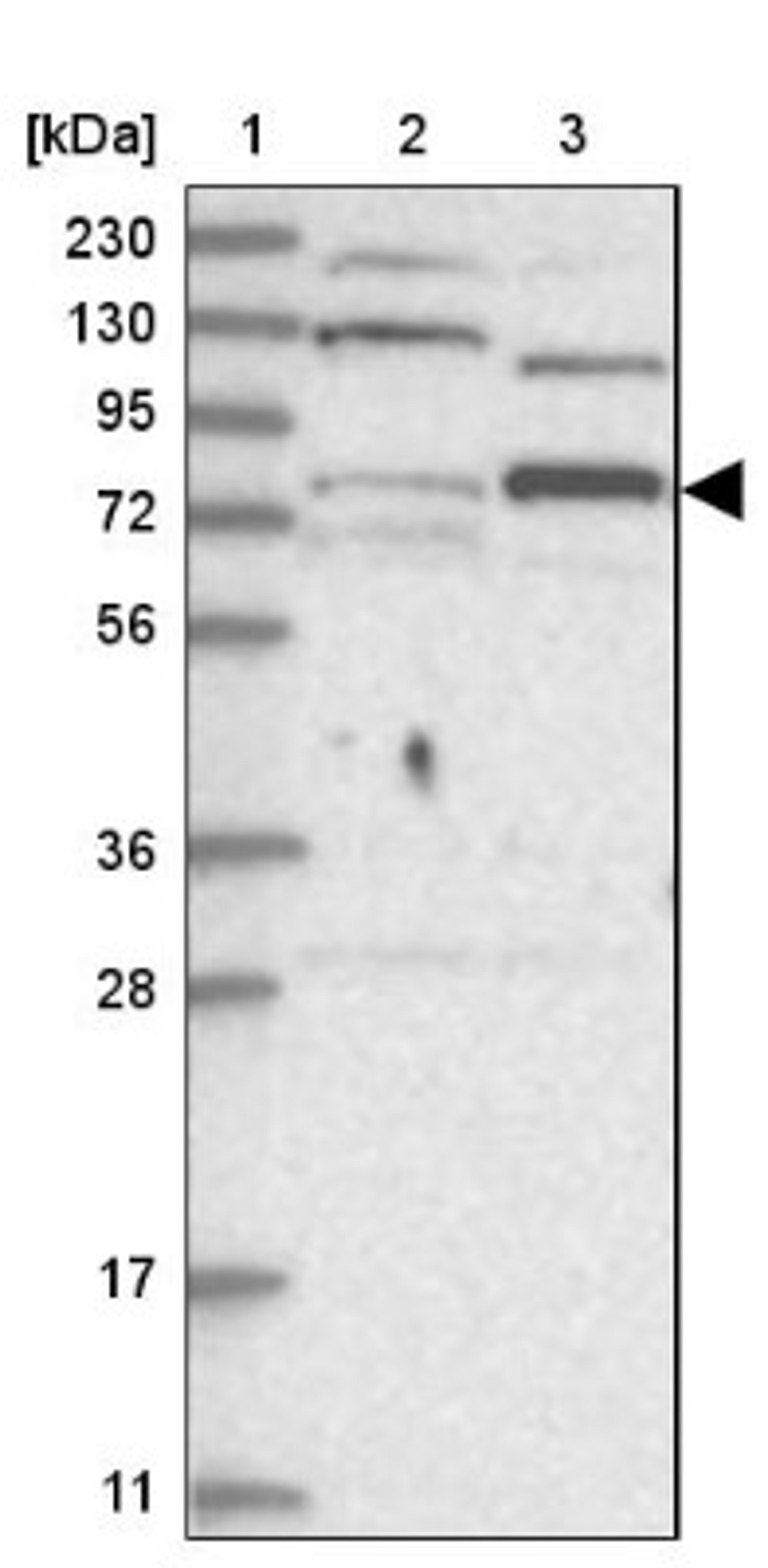 Western Blot: Zinc finger protein 287 Antibody [NBP1-82360] - Lane 1: Marker [kDa] 230, 130, 95, 72, 56, 36, 28, 17, 11<br/>Lane 2: Human cell line RT-4<br/>Lane 3: Human cell line U-251MG sp