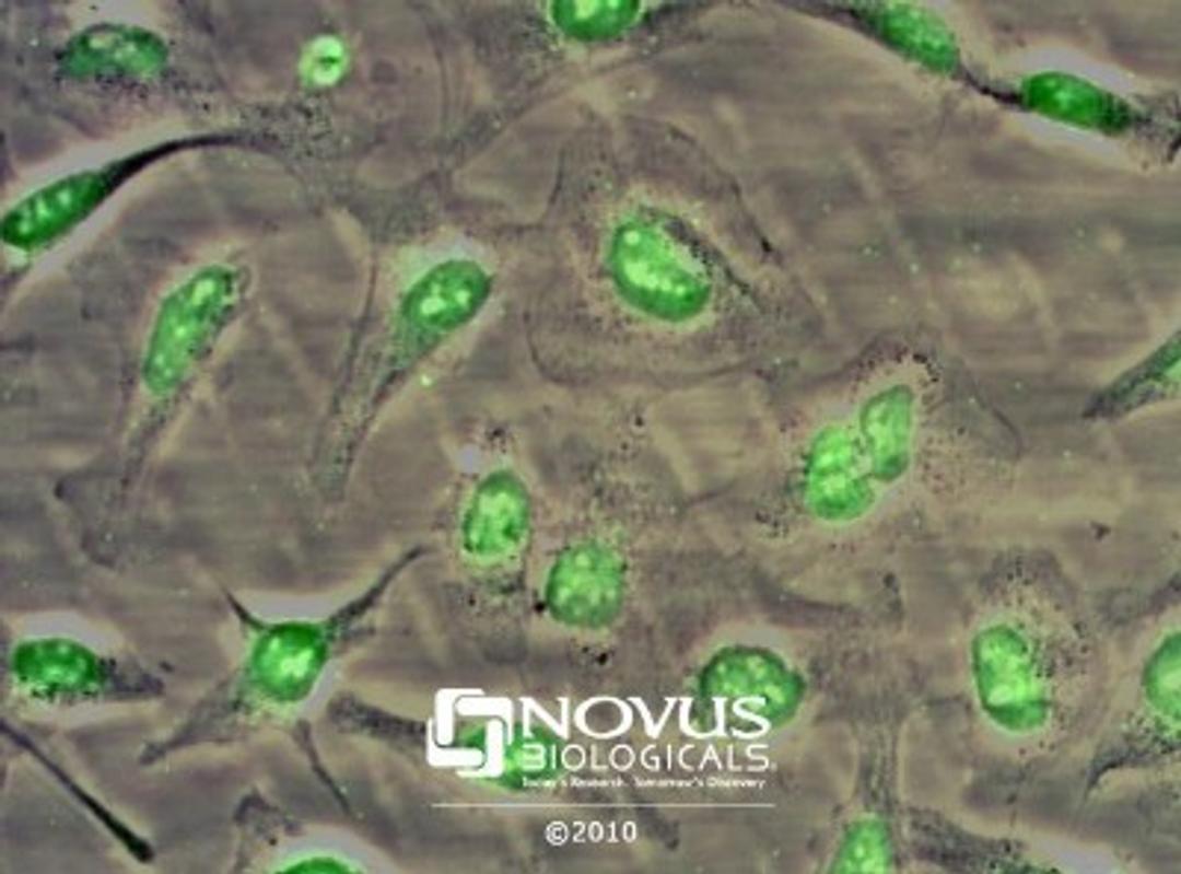 Immunocytochemistry/Immunofluorescence: NBS1 Antibody [NB100-143] - ICC staining of Hela cells using NB100-143 anti-NBS1.