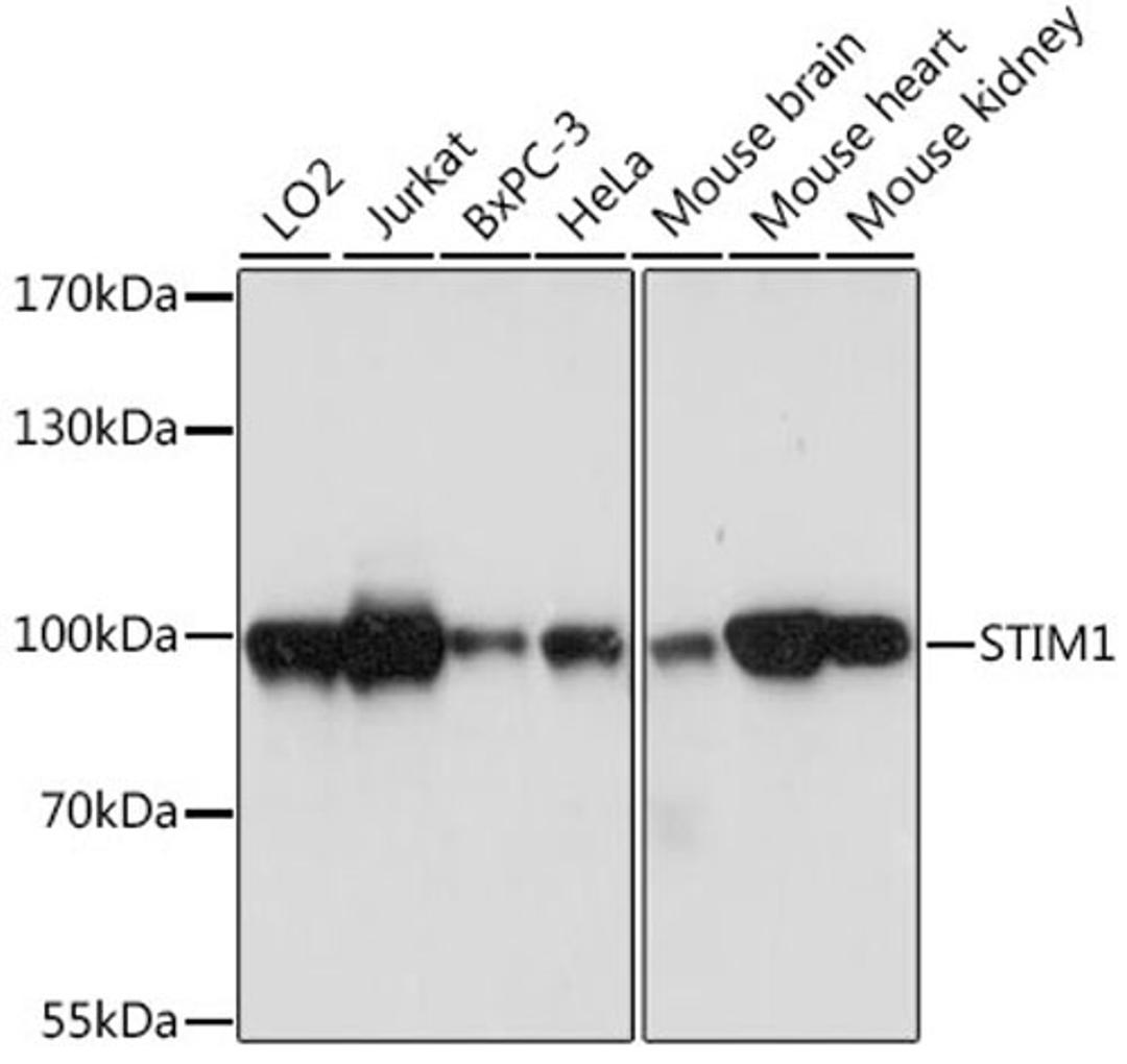 Western blot - STIM1 antibody (A7411)