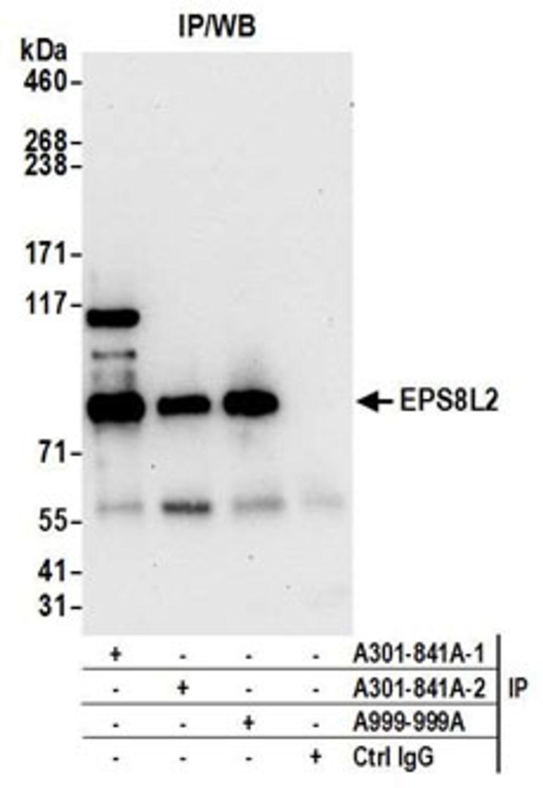 Detection of human EPS8L2 by western blot of immunoprecipitates.