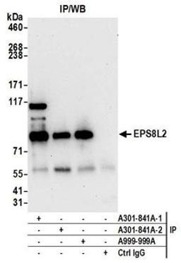 Detection of human EPS8L2 by western blot of immunoprecipitates.