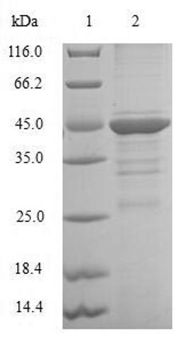 (Tris-Glycine gel) Discontinuous SDS-PAGE (reduced) with 5% enrichment gel and 15% separation gel.