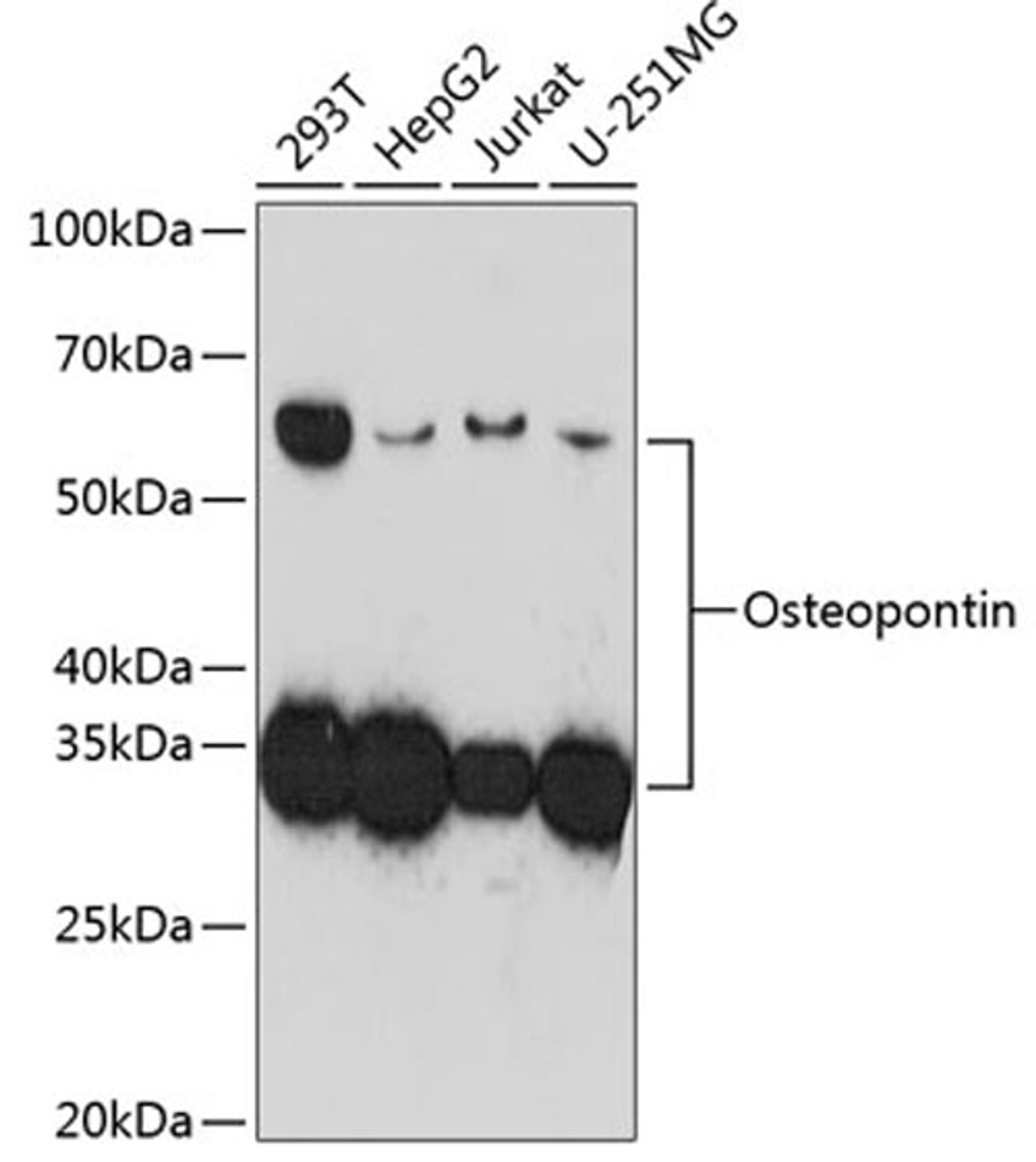 Western blot - Osteopontin antibody (A19092)