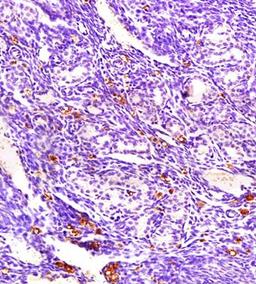 Immunohistochemical analysis of formalin fixed and paraffin embedded mouse endometrium tissue using ECM1 antibody