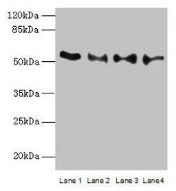 Western blot. All lanes: TRIM15 antibody at 2µg/ml. Lane 1: Jurkat whole cell lysate. Lane 2: Hela whole cell lysate. Lane 3: HepG2 whole cell lysate. Lane 4: A549 whole cell lysate. Secondary. Goat polyclonal to rabbit IgG at 1/10000 dilution. Predicted band size: 53, 13 kDa. Observed band size: 53 kDa