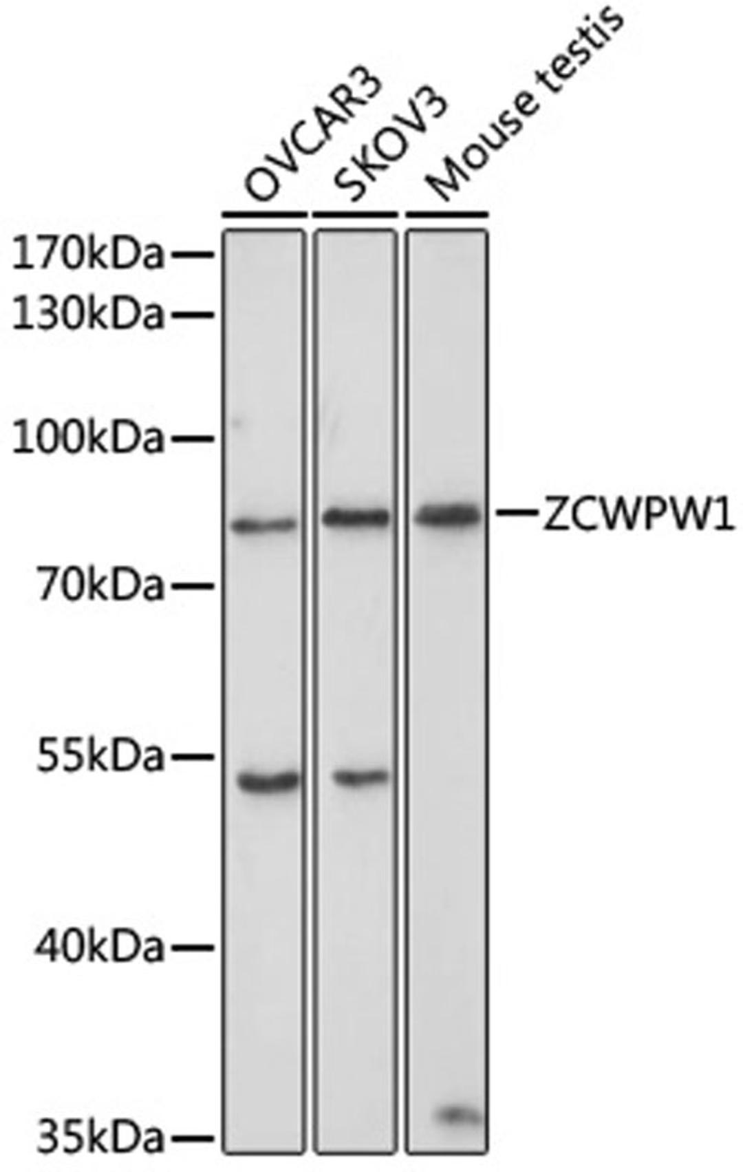 Western blot - ZCWPW1 antibody (A7596)