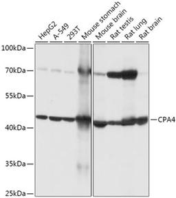 Western blot - CPA4 antibody (A17701)