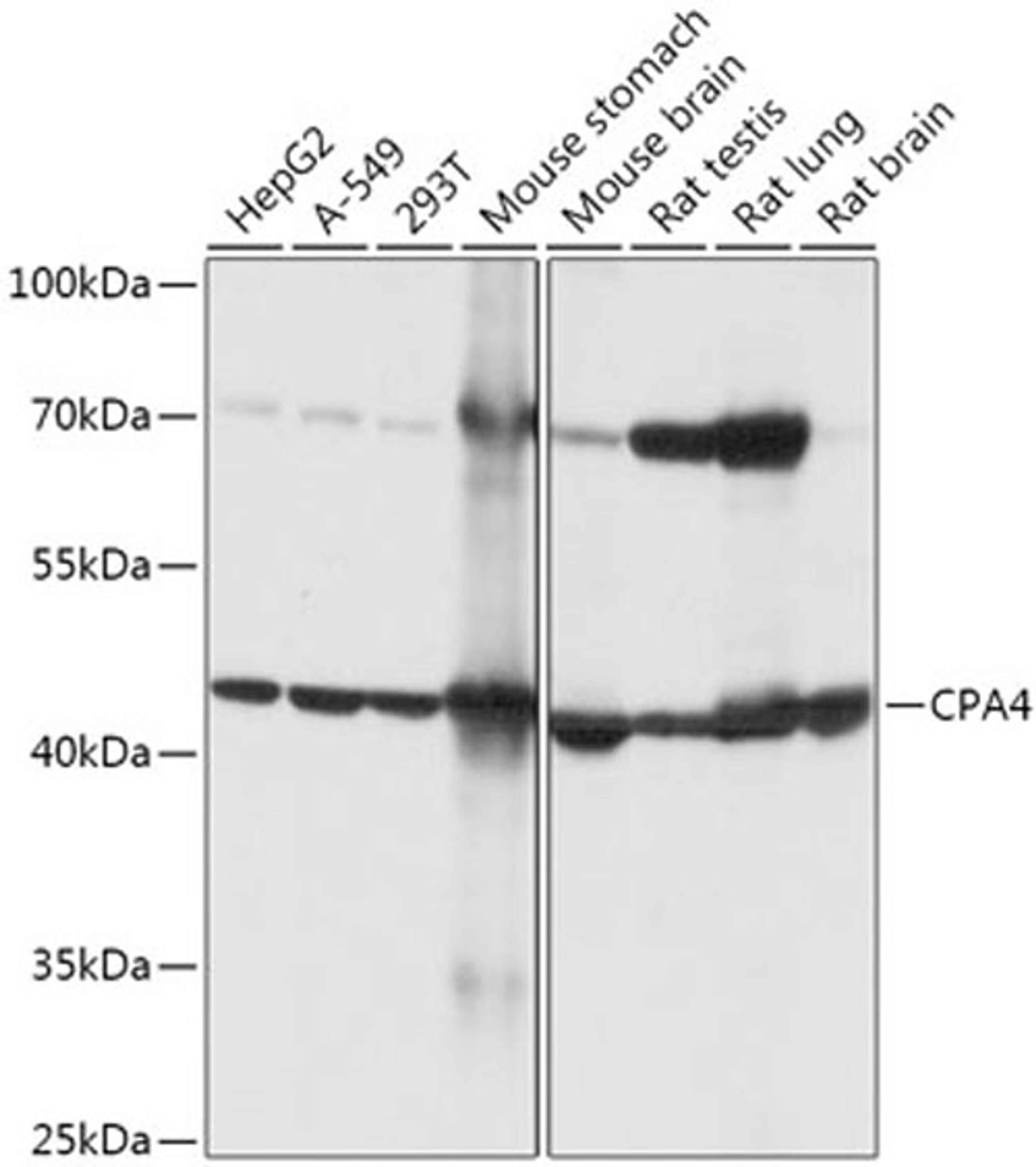 Western blot - CPA4 antibody (A17701)