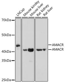 Western blot - AMACR antibody (A1130)