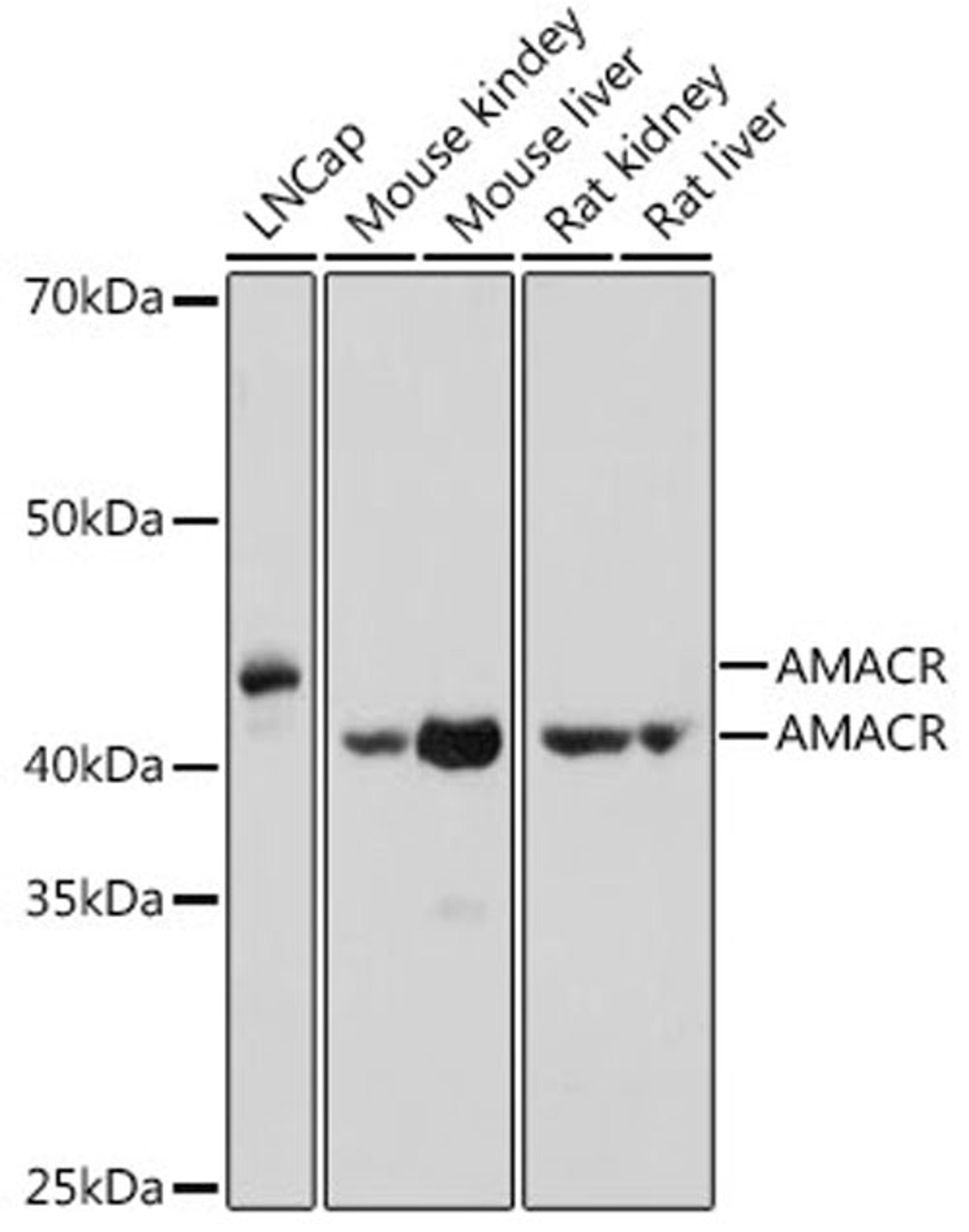 Western blot - AMACR antibody (A1130)