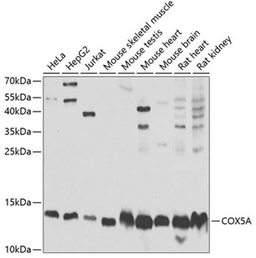 Western blot - COX5A Antibody (A6437)