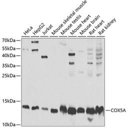 Western blot - COX5A Antibody (A6437)