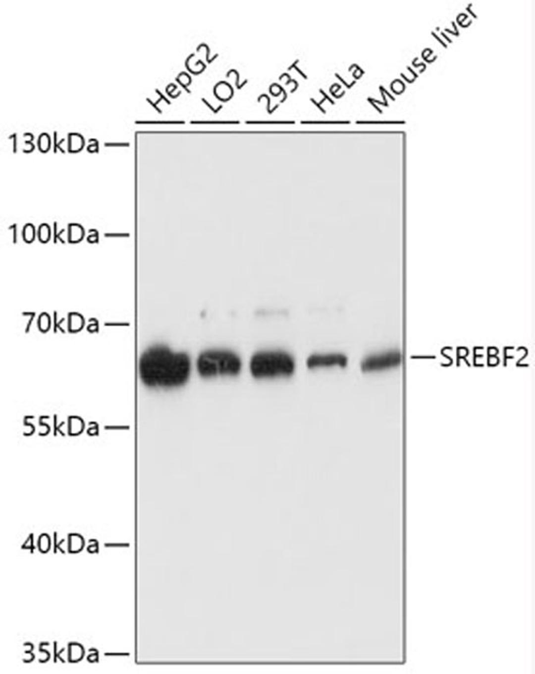 Western blot - SREBF2 antibody (A13049)