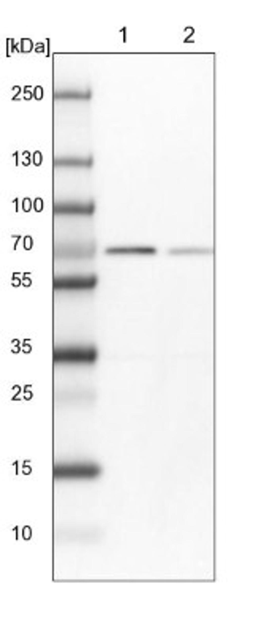 Western Blot: Annexin A6 Antibody [NBP1-90149] - Lane 1: NIH-3T3 cell lysate (Mouse embryonic fibroblast cells)<br/>Lane 2: NBT-II cell lysate (Rat Wistar bladder tumour cells)