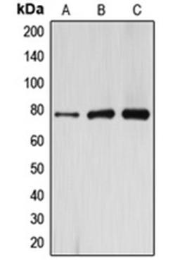 Western blot analysis of HeLa (Lane 1), mouse kidney (Lane 2), rat kidney (Lane 3) whole cell lysates using ARHGAP22 antibody