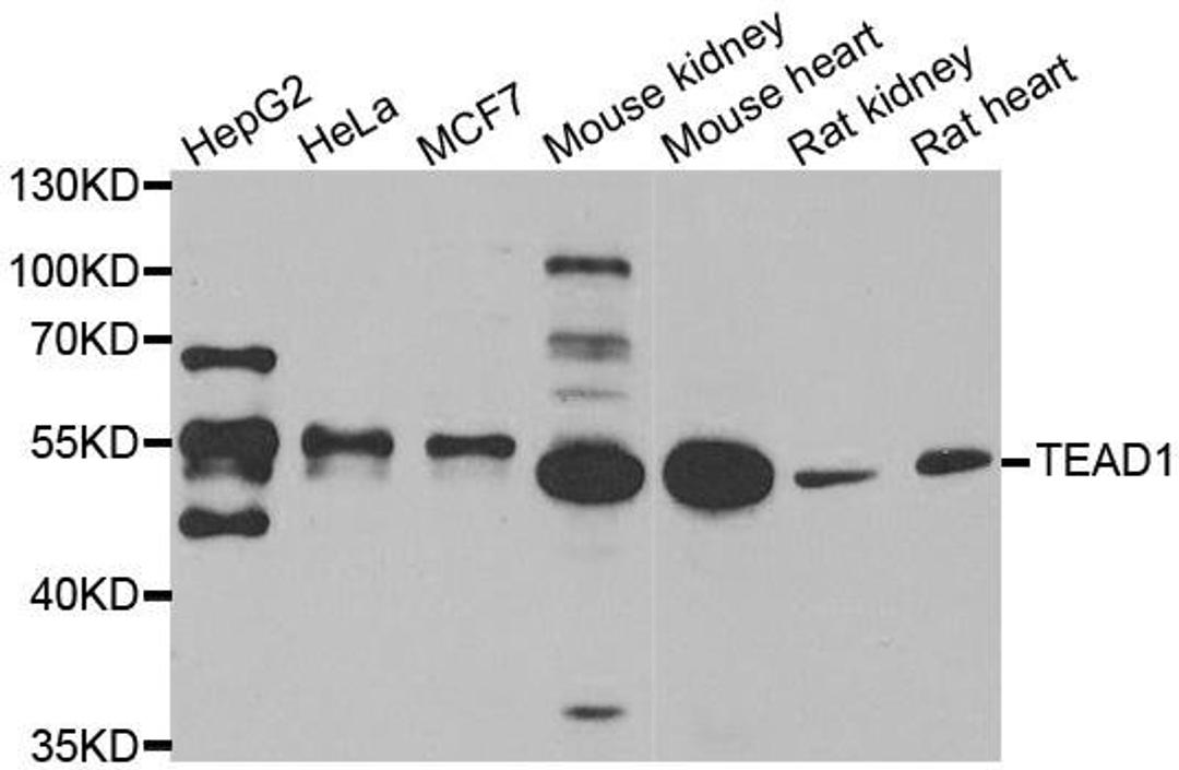 Western blot analysis of extracts of various cell lines using TEAD1 antibody