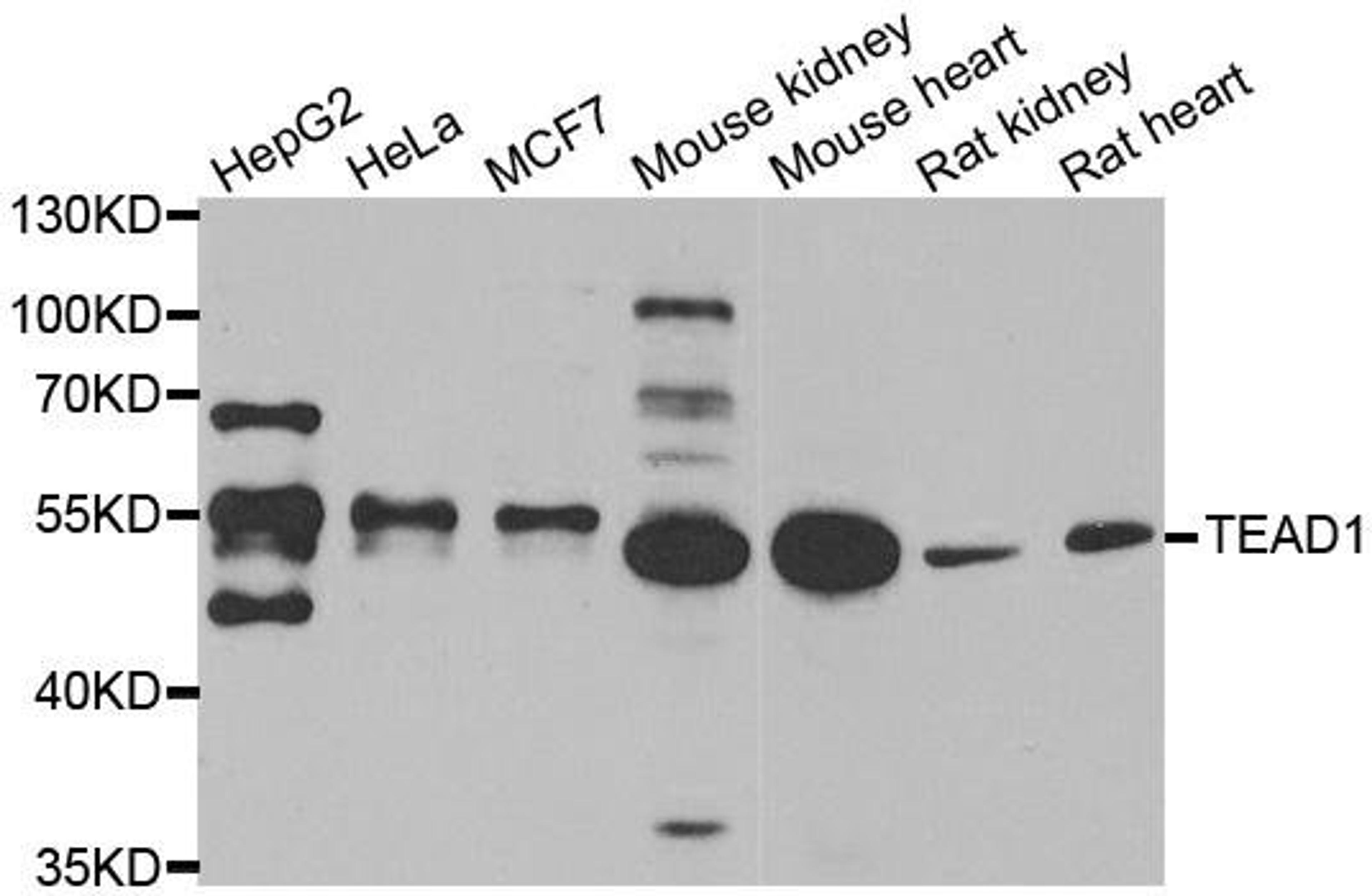 Western blot analysis of extracts of various cell lines using TEAD1 antibody