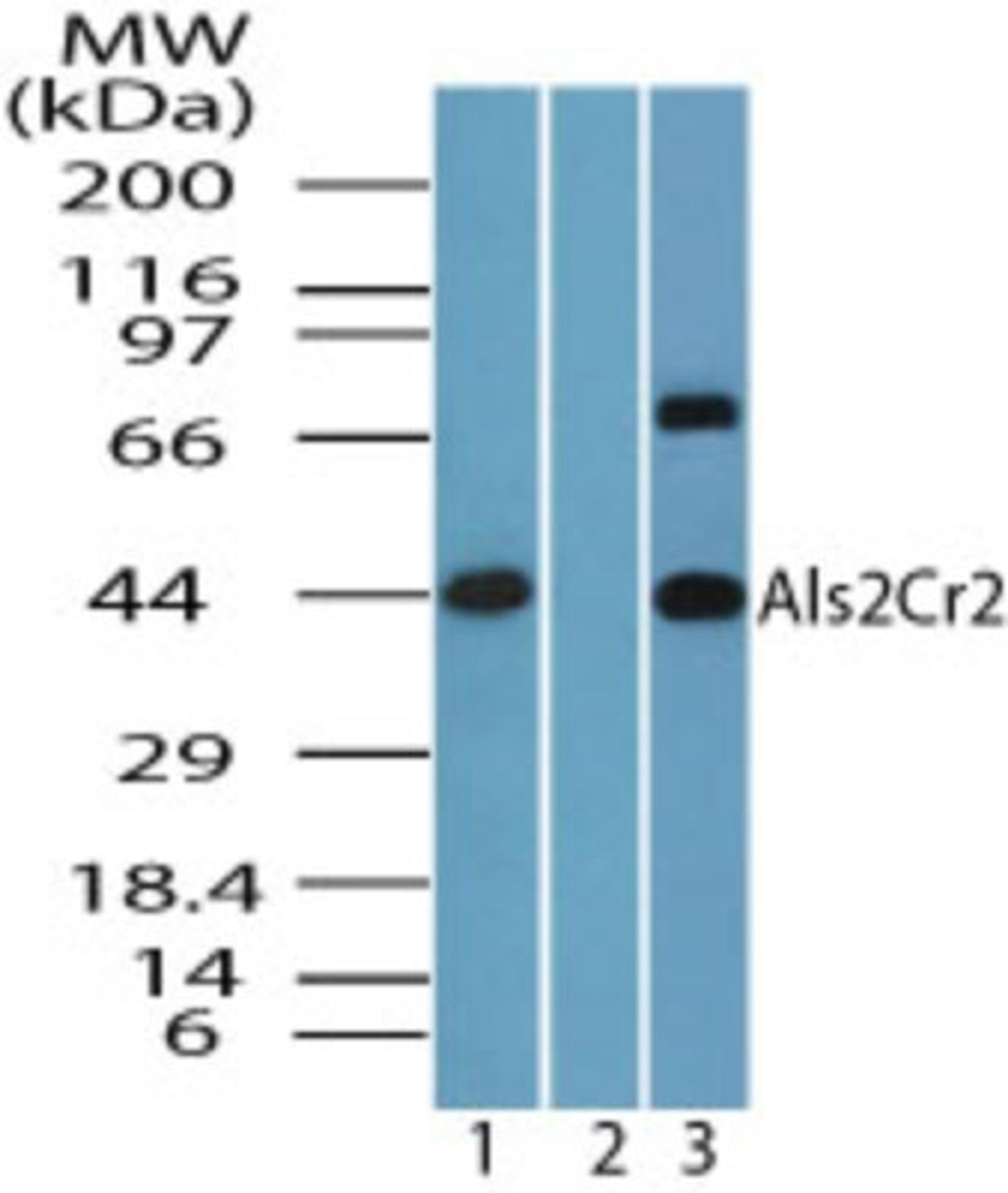 Western Blot: ALS2CR2 Antibody [NBP2-24680] - analysis of Als2Cr2 in human brain lysate in the 1) absence and 2) presence of immunizing peptide, and 3) mouse brain using Als2Cr2 antibody at 4.0 ug/ml and 2 ug/ml, respectively.