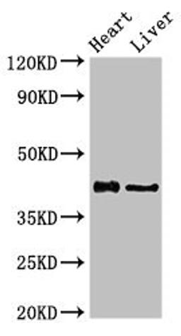 Western Blot. Positive WB detected in: Rat heart tissue, Rat liver tissue. All lanes: HDAC8 antibody at 2.5ug/ml. Secondary. Goat polyclonal to rabbit IgG at 1/50000 dilution. Predicted band size: 42, 30, 18, 32, 29, 16, 17 kDa. Observed band size: 42 kDa. 
