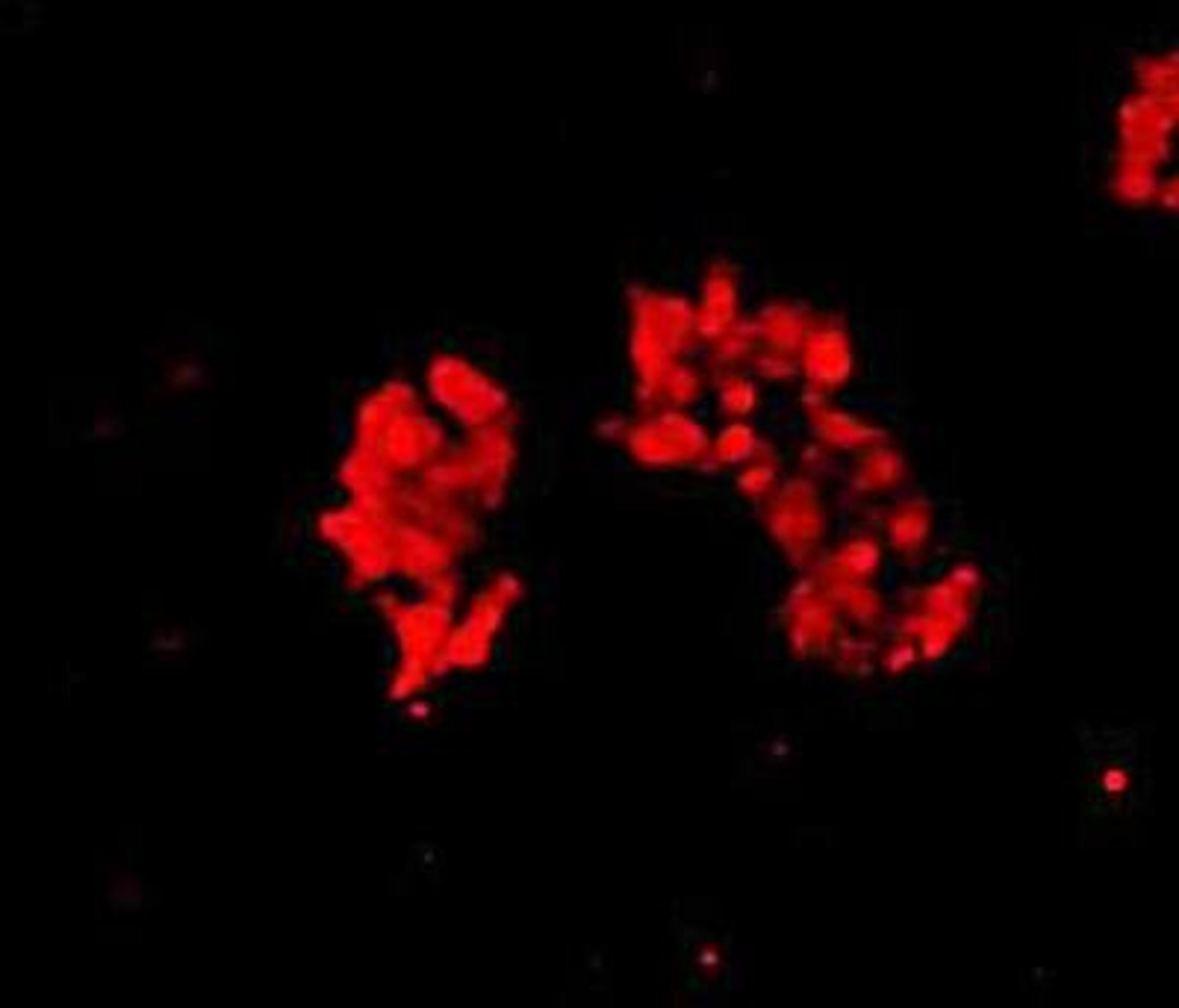 Immunofluorescent staining of Hela cells using alpha- cardiac actin antibody