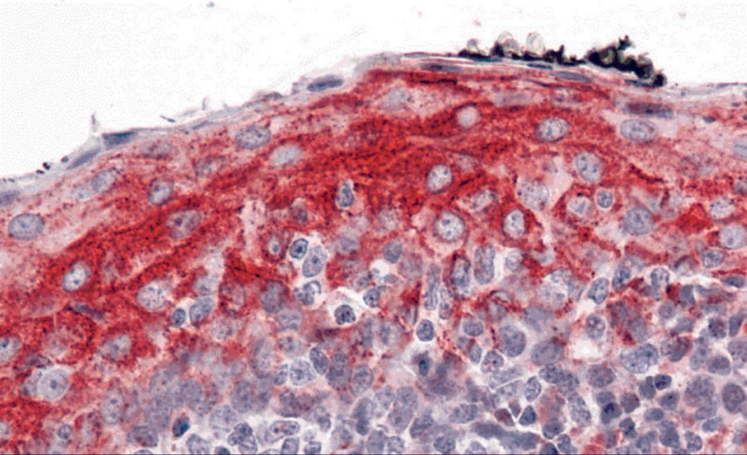 Immunohistochemistry of ZMYM4 in human tonsil with ZMYM4 antibody at 5 μg/mL.