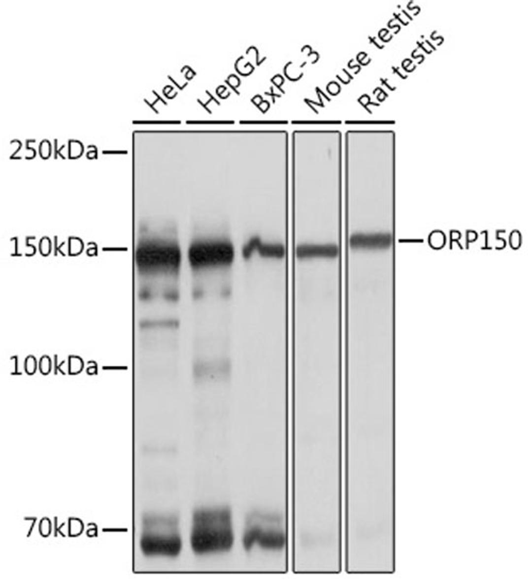 Western blot - ORP150 Rabbit mAb (A1042)