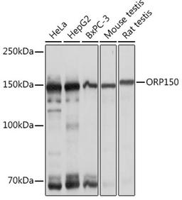 Western blot - ORP150 Rabbit mAb (A1042)