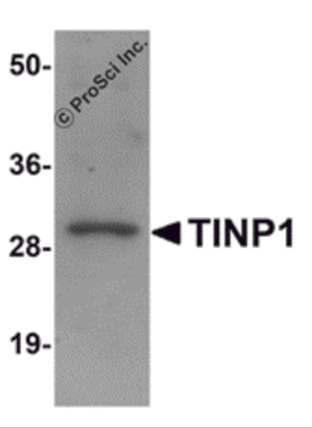 Western blot analysis of TINP1 in rat brain tissue lysate with TINP1 antibody at (A) 1 and (B) 2 μg/mL.