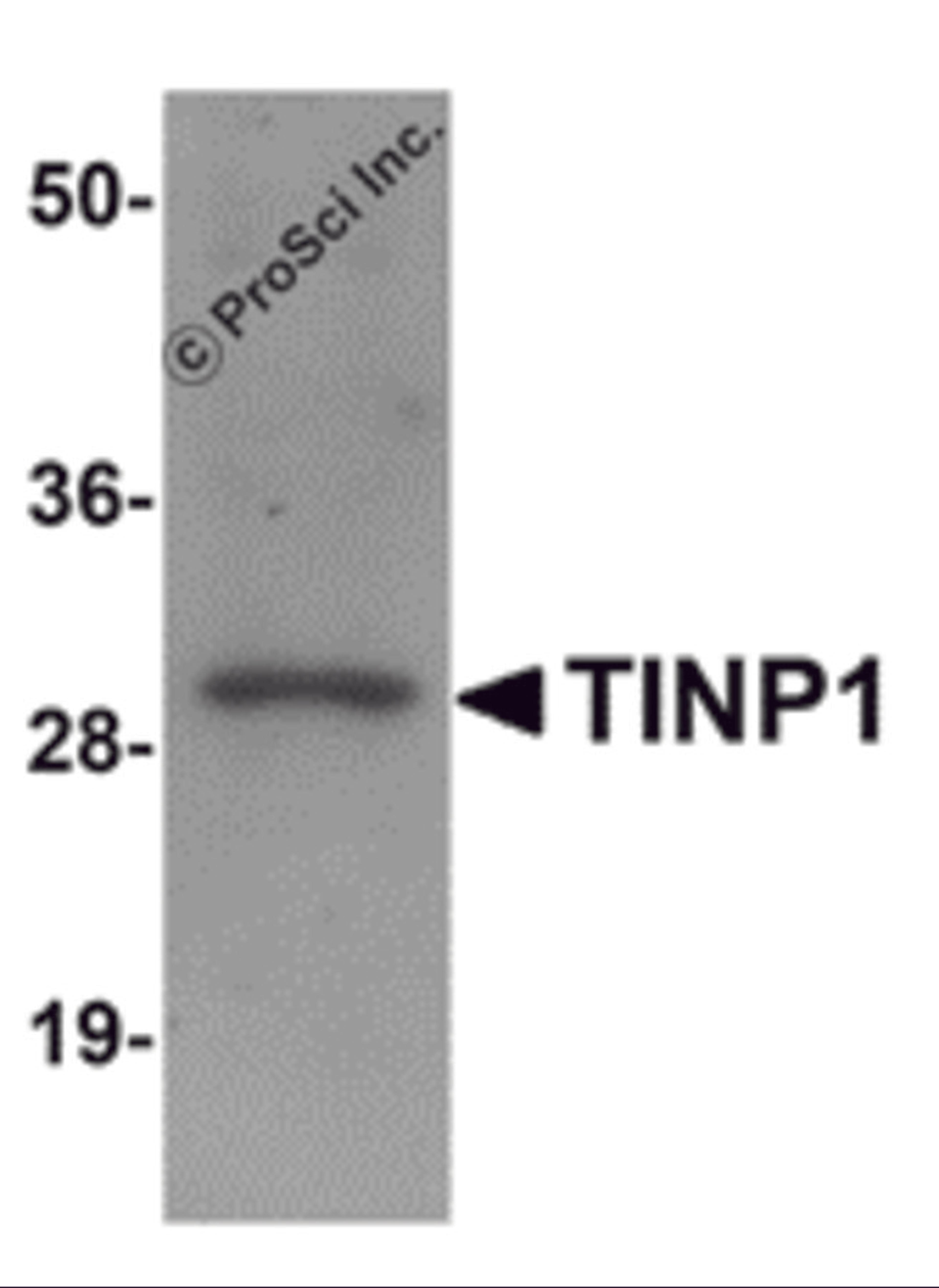 Western blot analysis of TINP1 in rat brain tissue lysate with TINP1 antibody at (A) 1 and (B) 2 μg/mL.