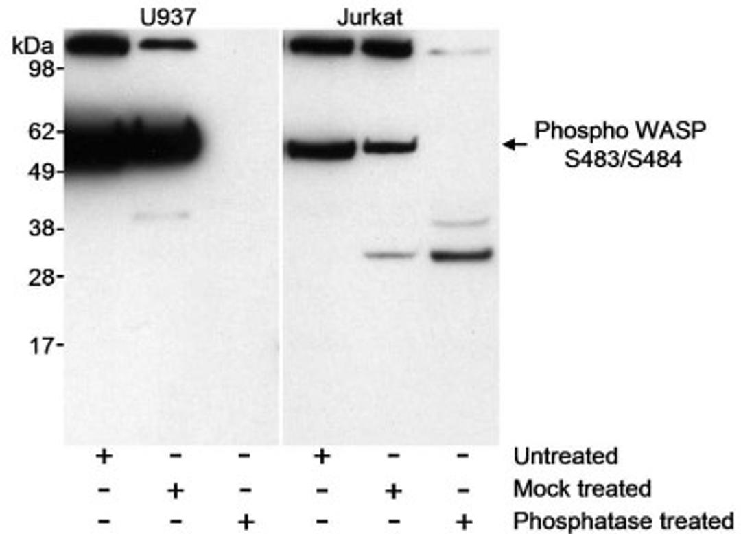 Western Blot: WASp [p Ser484] Antibody [NB100-2307] - Whole cell  lysate (50 ug/lane) from U937 and Jurkat cells. Lysates were either untreated, mock treated with phosphatase or treated with phosphatase.  Antibody used at 1 ug/ml.