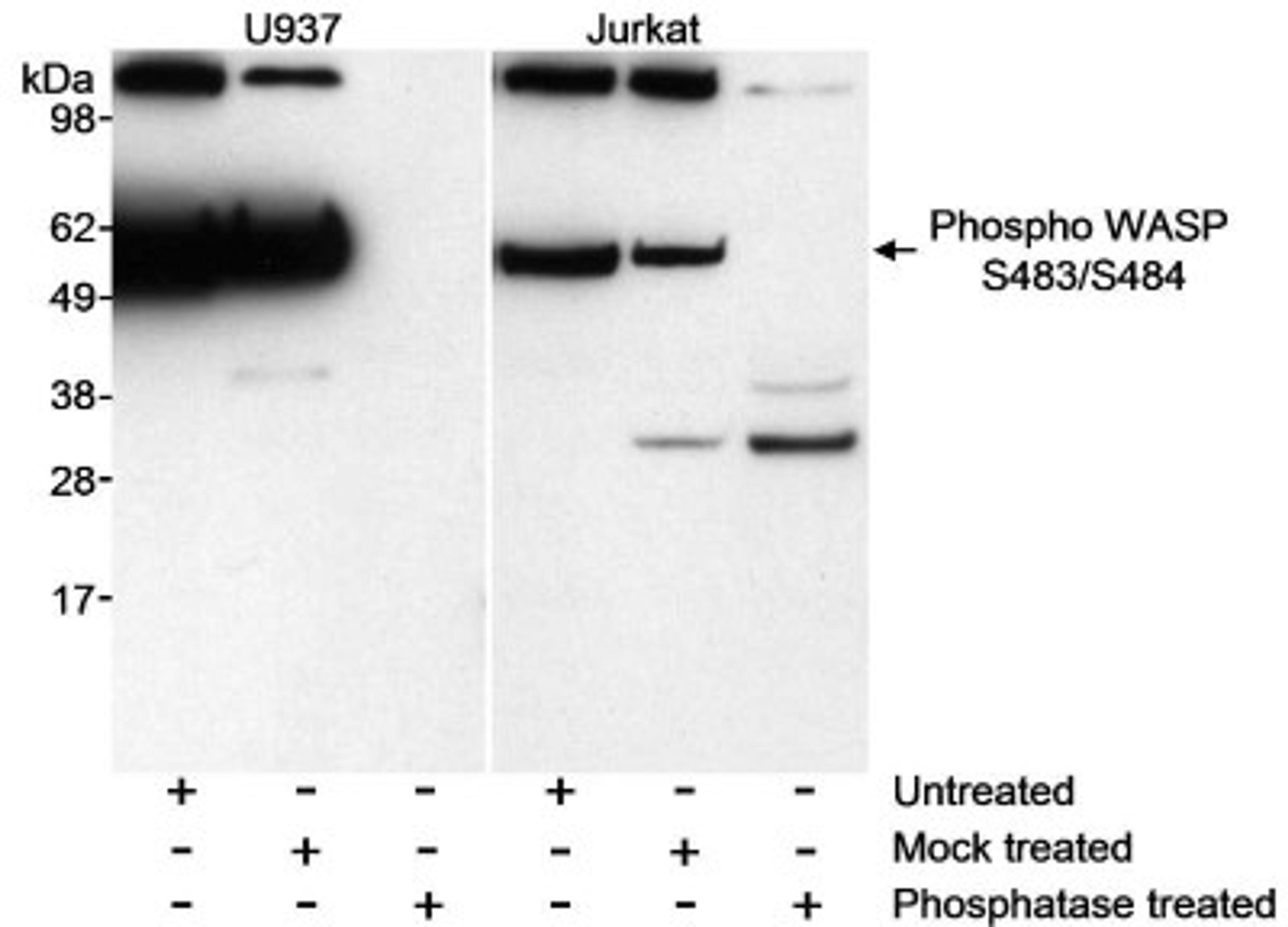 Western Blot: WASp [p Ser484] Antibody [NB100-2307] - Whole cell  lysate (50 ug/lane) from U937 and Jurkat cells. Lysates were either untreated, mock treated with phosphatase or treated with phosphatase.  Antibody used at 1 ug/ml.