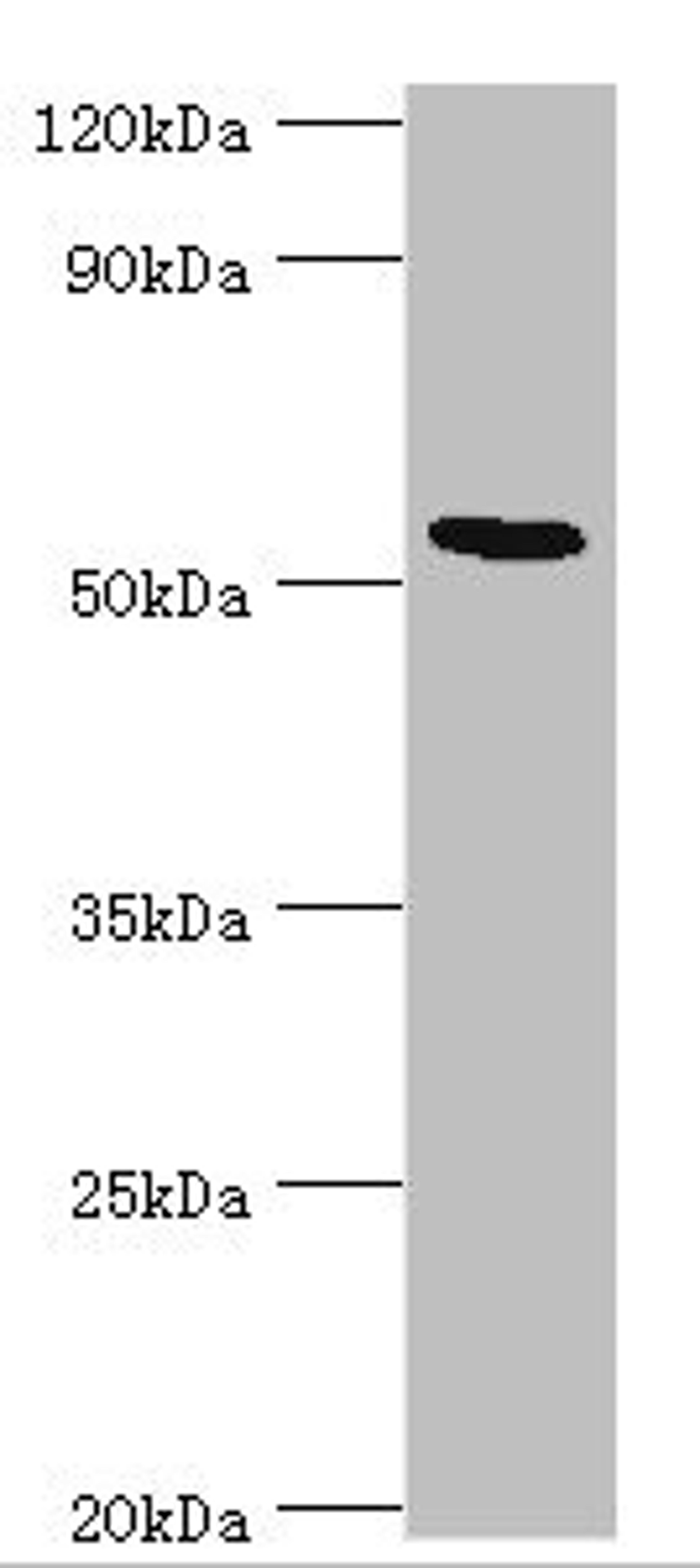 Western blot. All lanes: ATF7 antibody at 12ug/ml + Hela whole cell lysate. Secondary. Goat polyclonal to rabbit IgG at 1/10000 dilution. Predicted band size: 53, 50, 51, 34, 14, 52 kDa. Observed band size: 53 kDa.