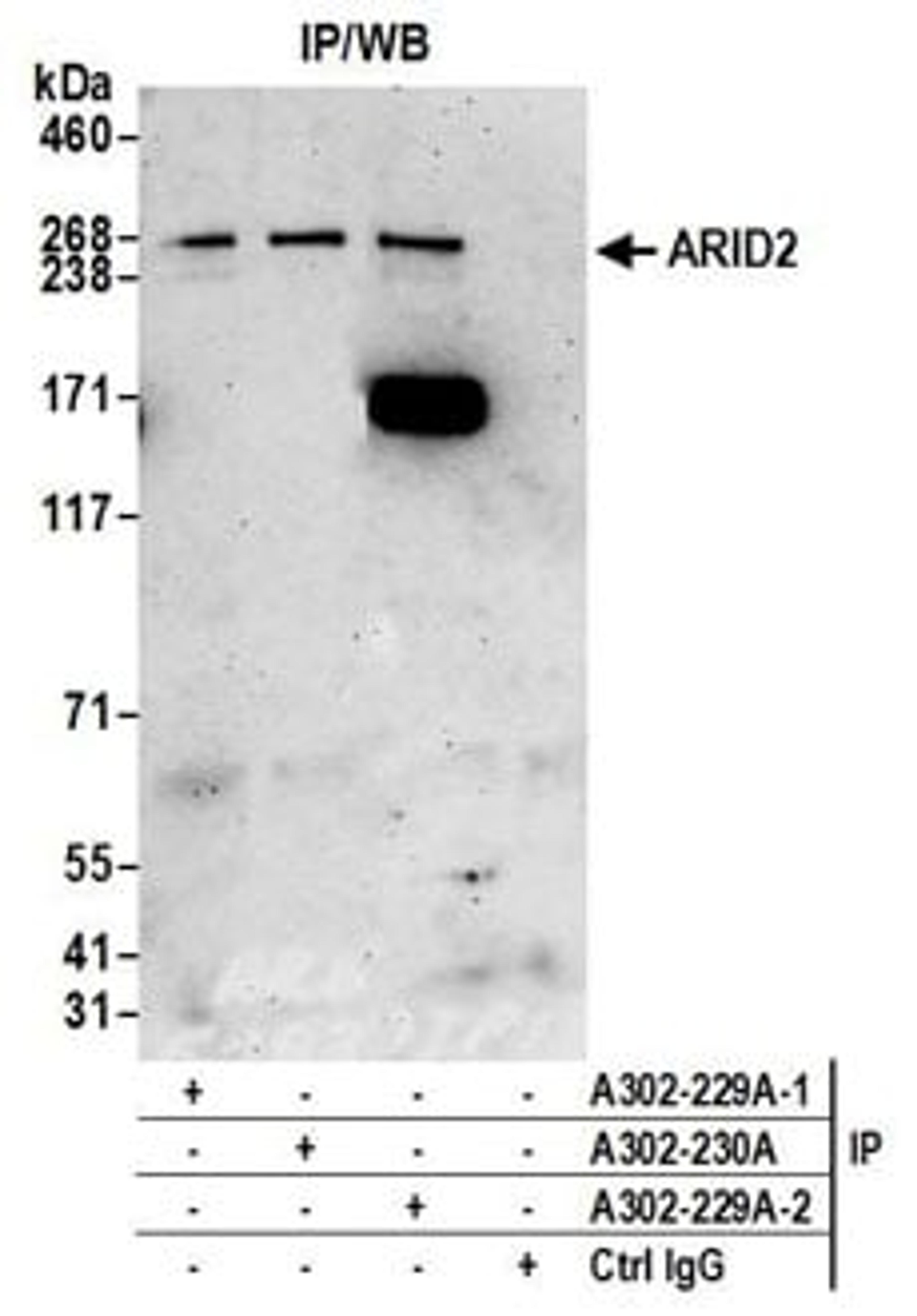 Detection of human ARID2 by western blot of immunoprecipitates.