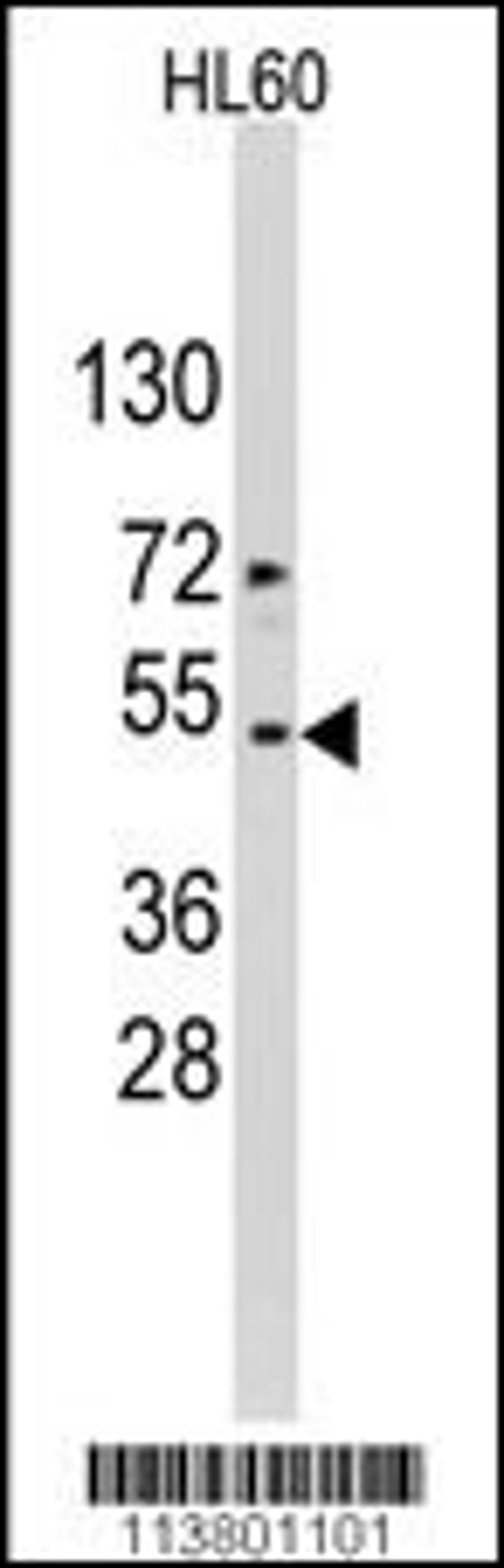 Western blot analysis of ACTB/ACTC Antibody in HL60 cell line lysates (35ug/lane).