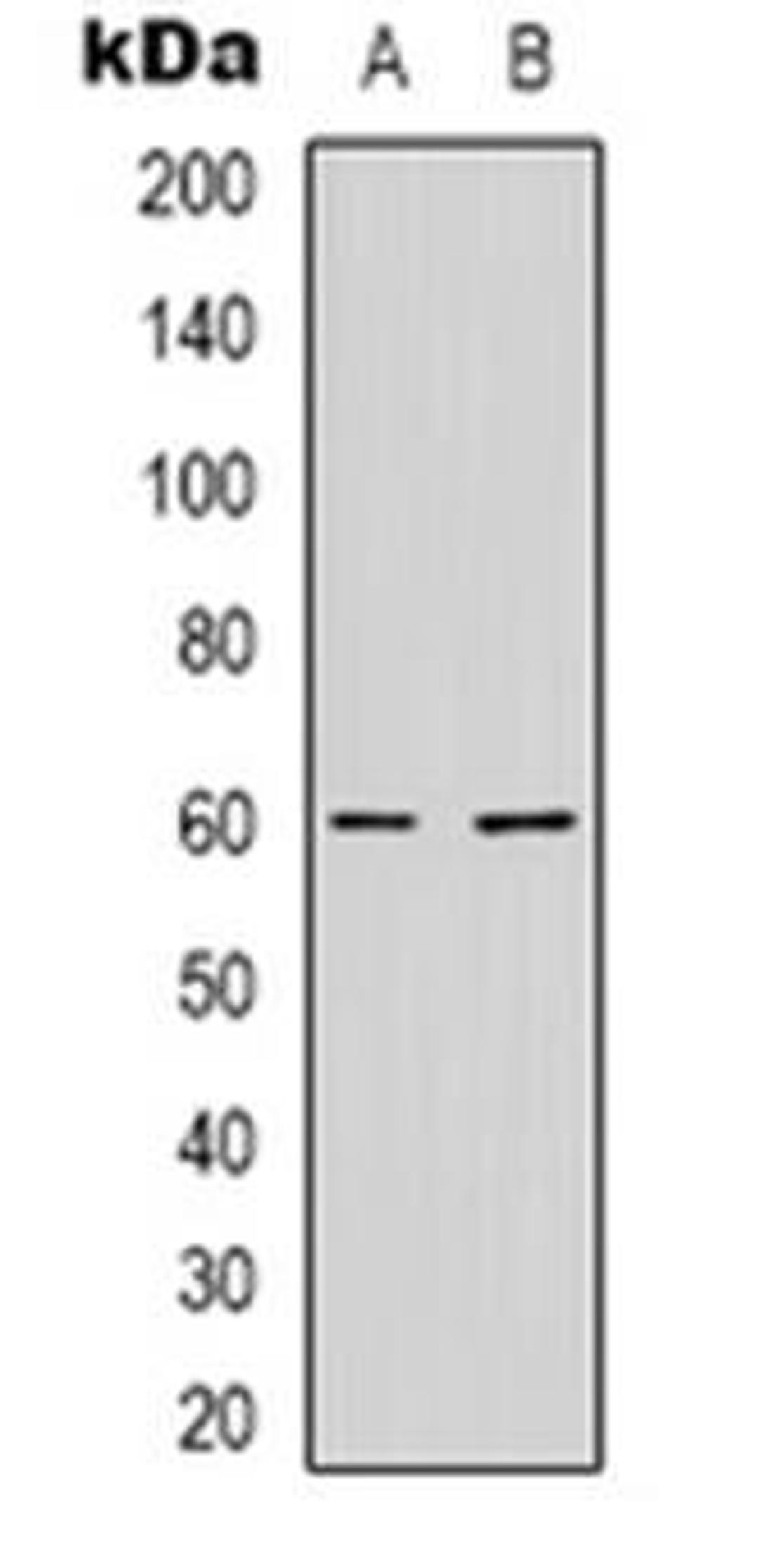 Western blot analysis of NXF3 expression in HepG2 (Lane 1), MCF7 (Lane 2) whole cell lysates using NXF3 antibody