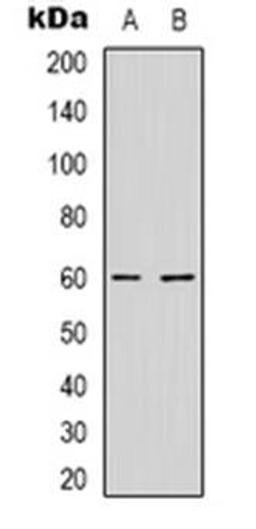 Western blot analysis of NXF3 expression in HepG2 (Lane 1), MCF7 (Lane 2) whole cell lysates using NXF3 antibody