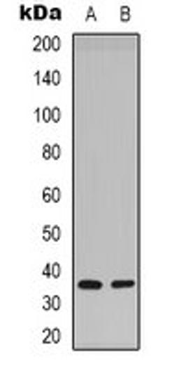 Western blot analysis of Hela (Lane 1), mouse brain (Lane 2) whole cell lysates using Syntaxin 1A (phospho-S14) antibody