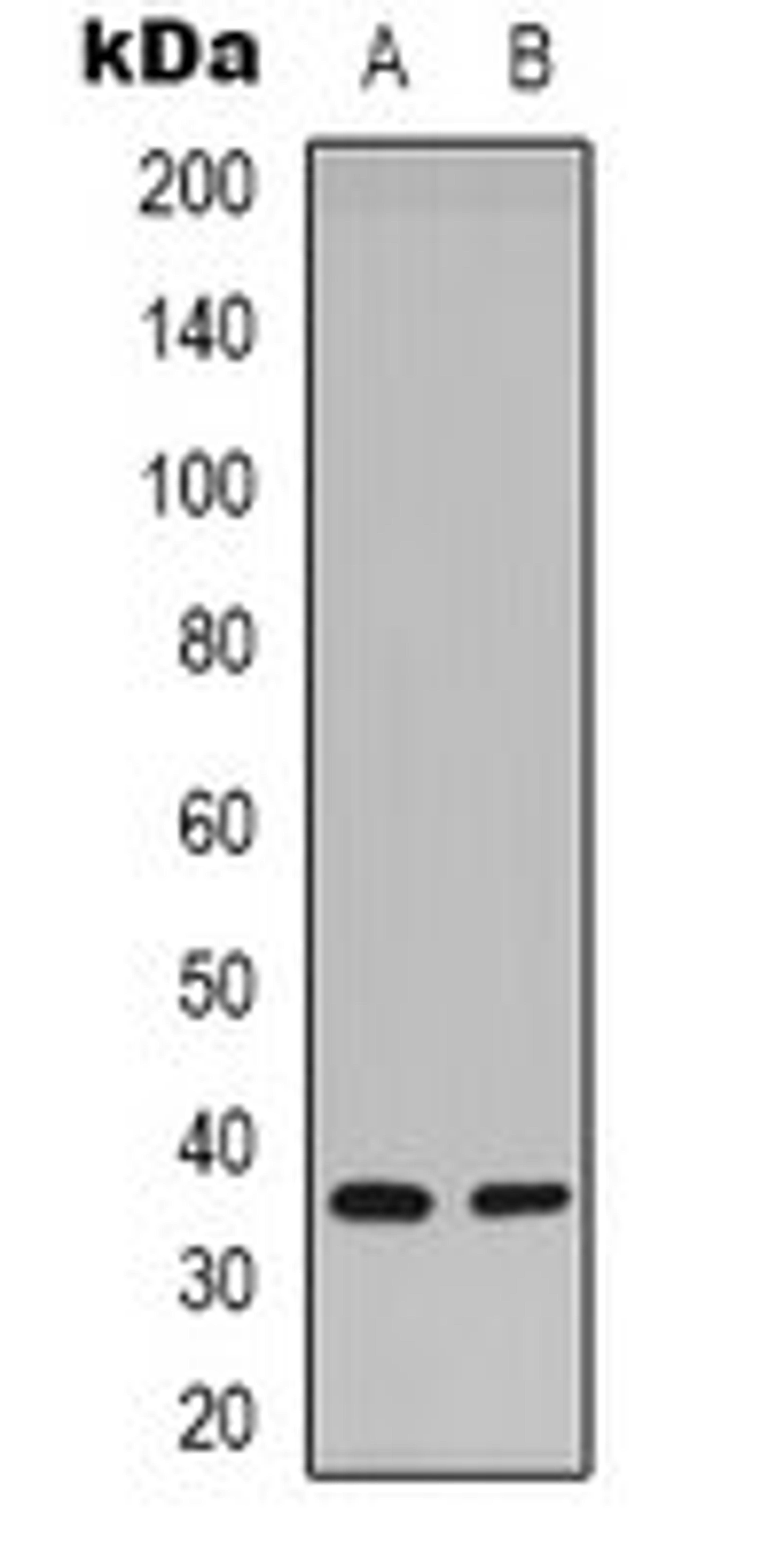 Western blot analysis of Hela (Lane 1), mouse brain (Lane 2) whole cell lysates using Syntaxin 1A (phospho-S14) antibody