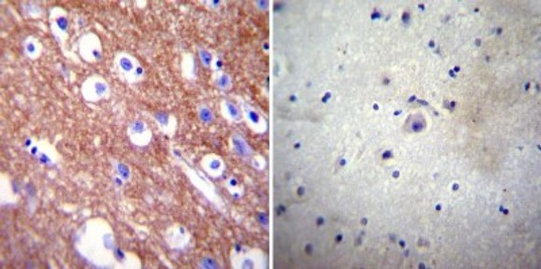 Immunohistochemistry-Paraffin: PMCA4 Antibody (JA9) [NB300-569] - Normal biopsies of deparaffinized Human brain tissue.