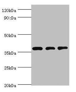 Western blot. All lanes: STRAP antibody at 8ug/ml. Lane 1: HepG2 whole cell lysate. Lane 2: Hela whole cell lysate. Lane 3: Mouse brain tissue. Secondary. Goat polyclonal to rabbit IgG at 1/10000 dilution. Predicted band size: 39, 40 kDa. Observed band size: 39 kDa. 