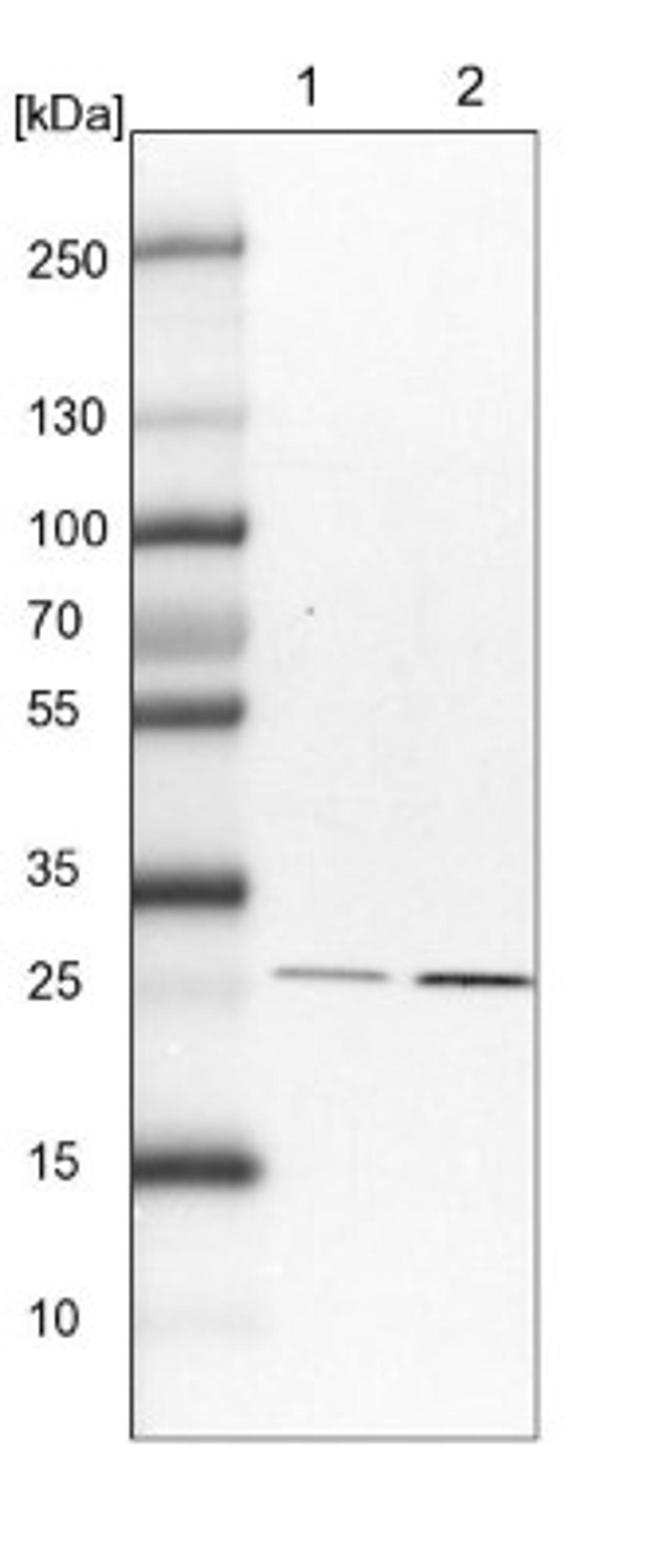 Western Blot: Proteasome beta 1 Antibody [NBP1-89714] - Lane 1: NIH-3T3 cell lysate (Mouse embryonic fibroblast cells)<br/>Lane 2: NBT-II cell lysate (Rat Wistar bladder tumour cells)