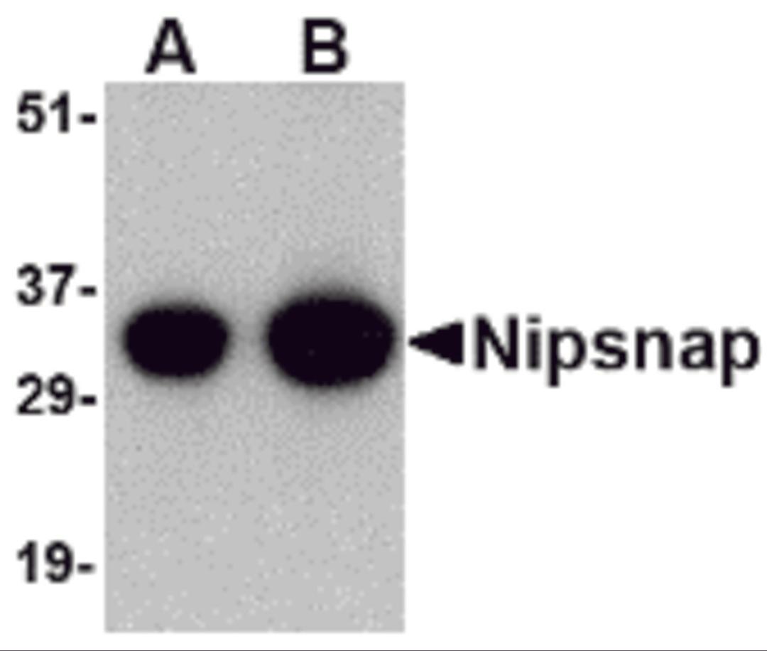 Western blot analysis of NIPSNAP in human brain tissue lysate with NIPSNAP antibody at (A) 0.5 and (B) 1 μg/mL.