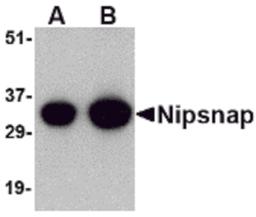 Western blot analysis of NIPSNAP in human brain tissue lysate with NIPSNAP antibody at (A) 0.5 and (B) 1 μg/mL.